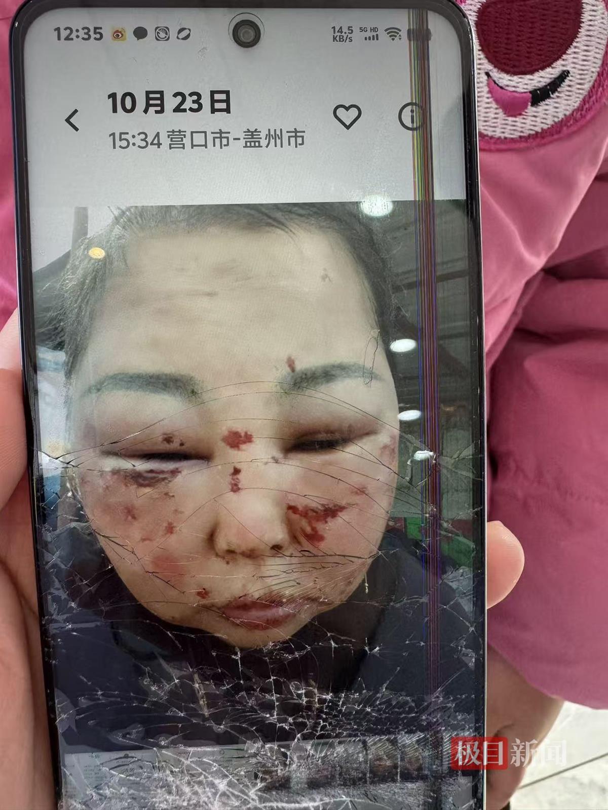 被前夫打进ICU的女子情况仍不稳定，其8岁女儿也曾遭父亲扇脸，律师：已构成故意伤害罪，或同时涉虐待罪